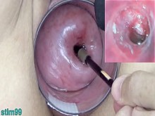 Madury Milf Cervix Play con endoscopio japonés Cam en el útero
